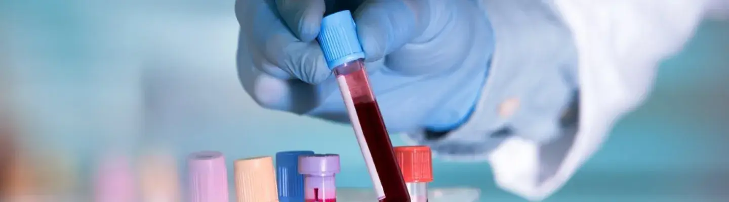 Липидограмма + коагулограмма со скидкой 15% - 1530 рублей вместо 1800 рублей.*